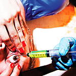 Racebannon – Acid Or Blood